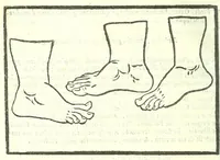 An illustration from Della fisonomia dell'huomo (1613)