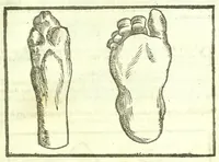 An illustration from Della fisonomia dell'huomo (1613)