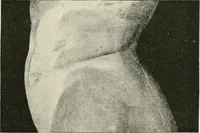 An illustration from Delphi (1920)