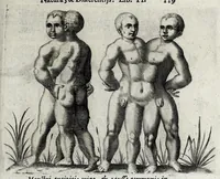 Picture 15 of 26 from De monstrorum caussis, natura, et differentiis libri duo : in quibus ex rei natura monstrorum historiae, caussae, generationes, & differentiae plurimae a sapientibus intactae : cum generatim & in plantarum, & belluarum genere, tum seorsum in humana specie tractantur : multis illustrium autorum locis difficillimis explanatis de masculo parturiente, de feminis in viros mutatis, de hermaphroditorum natura, de dissimilium specierum : venere prolifica, de castratorum fecunditate, depuero lapidescente, de anomantis aurea parte, alijsque admirabilibus (1634), leaf 153