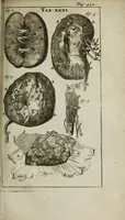 An illustration from De nieuw hervormde anatomie, ofte, Ontleding des menschen lichaams : gebouwd op de waaragtigste en naaukeurigste ondervindingen deser eeuw : zijnde met een groot getal kunstige platen vercʹiert : als ook een verhandelinge van het balsemen der lichamen : noit voor desen dusdanig bekent gemaakt (1686)