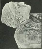 An illustration from Denkmäler des klassischen Altertums, zur Erläuterung des Lebens der Griechen und Römer in Religion, Kunst und Sitte (1887)