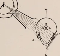 An illustration from Dental and oral radiography : a text book for students and practitioners of dentistry (1916)