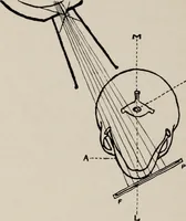 An illustration from Dental and oral radiography : a text book for students and practitioners of dentistry (1916)