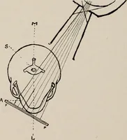 An illustration from Dental and oral radiography : a text book for students and practitioners of dentistry (1916)