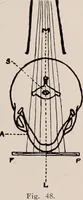An illustration from Dental and oral radiography : a text book for students and practitioners of dentistry (1916)