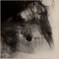 An illustration from Dental and oral radiography : a text book for students and practitioners of dentistry (1916)