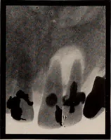 An illustration from Dental and oral radiography : a text book for students and practitioners of dentistry (1916)