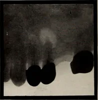 An illustration from Dental and oral radiography : a text book for students and practitioners of dentistry (1916)