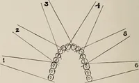 An illustration from Dental and oral radiography : a text book for students and practitioners of dentistry (1916)
