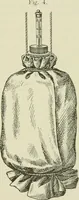 An illustration from Der Hitzschlag auf Märschen : mit Benutzung der Akten der Medicinal-Abtheilung des Preussischen Kriegs-Ministeriums (1902)