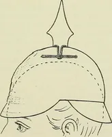 An illustration from Der Hitzschlag auf Märschen : mit Benutzung der Akten der Medicinal-Abtheilung des Preussischen Kriegs-Ministeriums (1902)
