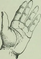 An illustration from Descriptive mentality from the head, face and hand (1899)