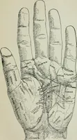 An illustration from Descriptive mentality from the head, face and hand (1899)