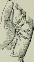 An illustration from Descriptive mentality from the head, face and hand (1899)