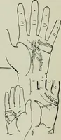 An illustration from Descriptive mentality from the head, face and hand (1899)