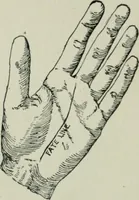 An illustration from Descriptive mentality from the head, face and hand (1899)