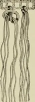 An illustration from The dictionary of needlework : an encyclopaedia of artistic, plain, and fancy needlework dealing fully with the details of all the stitches employed, the method of working, the materials used, the meaning of technical terms, and, where necessary, tracing the origin and history of the various works described (1882)