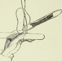 An illustration from The dictionary of needlework : an encyclopaedia of artistic, plain, and fancy needlework dealing fully with the details of all the stitches employed, the method of working, the materials used, the meaning of technical terms, and, where necessary, tracing the origin and history of the various works described (1882)