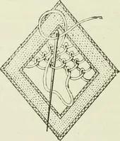 An illustration from The dictionary of needlework : an encyclopaedia of artistic, plain, and fancy needlework dealing fully with the details of all the stitches employed, the method of working, the materials used, the meaning of technical terms, and, where necessary, tracing the origin and history of the various works described (1882)