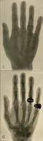 An illustration from Die Einrichtungen zur Erzeugung der Roentgenstrahlen (1903)