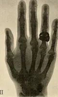 Picture 58 of 120 from Die Einrichtungen zur Erzeugung der Roentgenstrahlen (1903), leaf 118