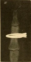 Picture 118 of 120 from Die Einrichtungen zur Erzeugung der Roentgenstrahlen (1903), leaf 212