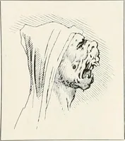 An illustration from Die Karikatur und Satire in der Medizin : mediko-kunsthistorische Studie (1921)