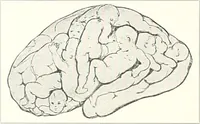 An illustration from Die Karikatur und Satire in der Medizin : mediko-kunsthistorische Studie (1921)