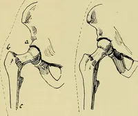 An illustration from Die Kultur des weiblichen Körpers als Grundlage der Frauenkleidung (1902)