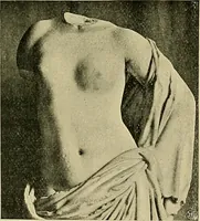 An illustration from Die Kultur des weiblichen Körpers als Grundlage der Frauenkleidung (1902)