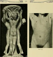 An illustration from Die Kultur des weiblichen Körpers als Grundlage der Frauenkleidung (1902)