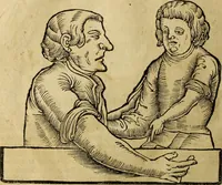 Picture 53 of 94 from Die Kunst der Chiromantzey : vsz Besehung der Hend. Physiognomey / vsz Anblick des Menschens. Natürlichen Astrologey noch dem Lauff der Soñen. Complexion eins yegklichen Menschens. Natürlichen Ynflüssz der Planeten. der zwolff Zeichen Angesychten. Ettliche Canones / zu Erkantnüsz der Menschen Kranckheiten / solicher weisz vormals nye beschriben oder gedruckt. Zusamen verordnet / vnd verteütscht durch ... (1523), leaf 81