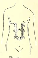 An illustration from Die Masai. Ethnographische Monographie eines ostafrikanischen Semitenvolkes (1910)