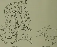 An illustration from Die praenestinischen Spiegel, ein Beitrag zur italischen Kunst- und Kulturgeschichte (1912)
