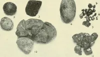 An illustration from Die Röntgenstrahlen im Dienste der Chirurgie (1902)