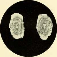 An illustration from Die Röntgenstrahlen im Dienste der Chirurgie (1902)