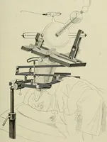 An illustration from Die Röntgentechnik : Lehrbuch für Ärzte und Studierende (1906)