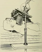 An illustration from Die Röntgentechnik : Lehrbuch für Ärzte und Studierende (1906)