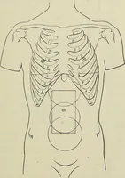 Picture 72 of 145 from Die Röntgentechnik : Lehrbuch für Ärzte und Studierende (1906), leaf 238
