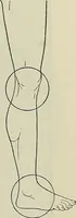 An illustration from Die Röntgentechnik : Lehrbuch für Ärzte und Studierende (1906)