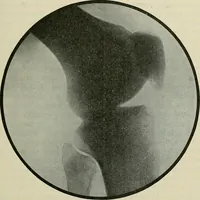 An illustration from Die Röntgentechnik : Lehrbuch für Ärzte und Studierende (1906)