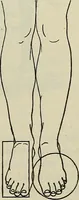 An illustration from Die Röntgentechnik : Lehrbuch für Ärzte und Studierende (1906)