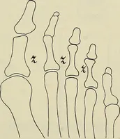 An illustration from Die Röntgentechnik : Lehrbuch für Ärzte und Studierende (1906)