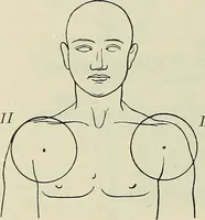 An illustration from Die Röntgentechnik : Lehrbuch für Ärzte und Studierende (1906)