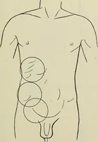 An illustration from Die Röntgentechnik : Lehrbuch für Ärzte und Studierende (1906)