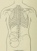Picture 98 of 145 from Die Röntgentechnik : Lehrbuch für Ärzte und Studierende (1906), leaf 307