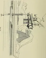 Picture 100 of 145 from Die Röntgentechnik : Lehrbuch für Ärzte und Studierende (1906), leaf 309