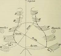 Picture 127 of 145 from Die Röntgentechnik : Lehrbuch für Ärzte und Studierende (1906), leaf 395