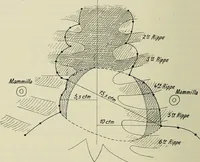 Picture 132 of 145 from Die Röntgentechnik : Lehrbuch für Ärzte und Studierende (1906), leaf 407